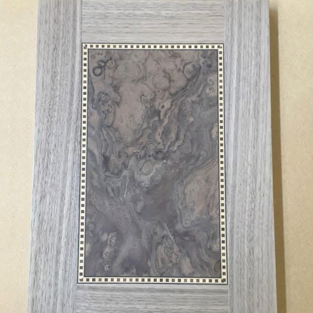 Regency Veneers