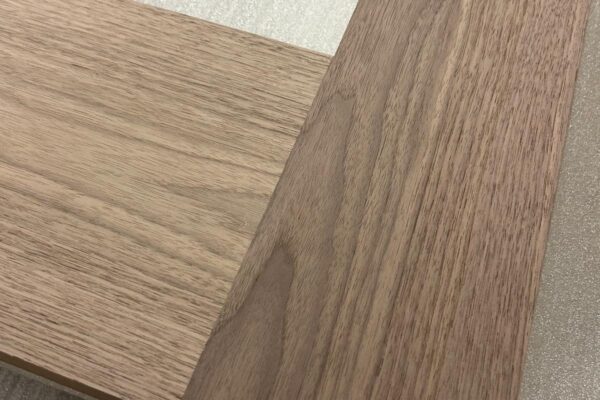 Regency Veneers